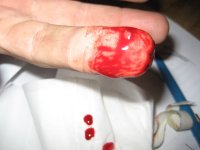 Blood2.jpg
